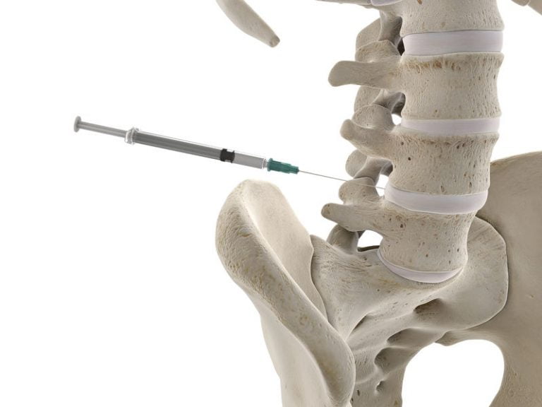 lumbar spine injection