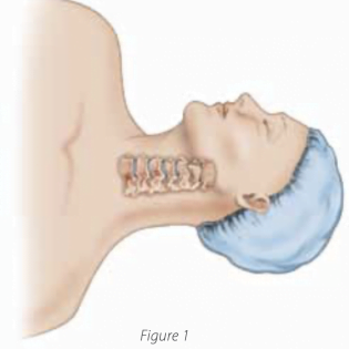 Cervical Spine Surgeries - Dr Nikhil Arbatti